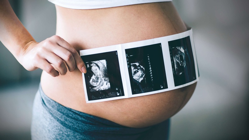 تاثیر جنسیت جنین بر دیابت بارداری