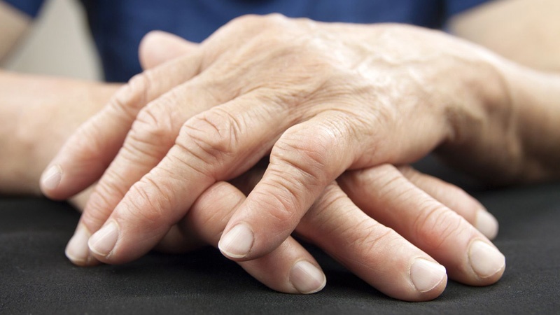 آرتروز دست چیست؟ علل و علائم
